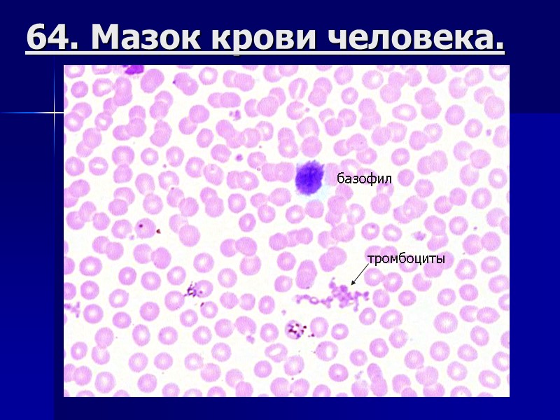 64. Мазок крови человека. базофил тромбоциты
